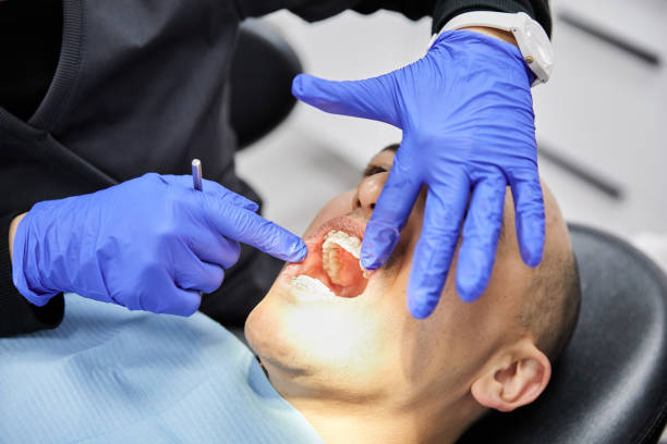 Best Emergency Wisdom Tooth Extraction in Rlsbad, CA